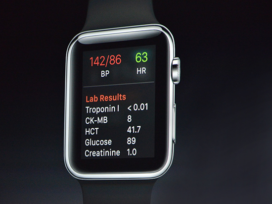Apple Watch 2配置及功能的八大預(yù)測